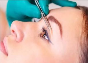بلفاروپلاستی درمان افتادگی پلک و زیبایی