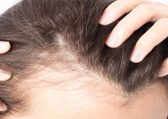 معرفی 8 تا روش های کاشت مو مزایا و معایب